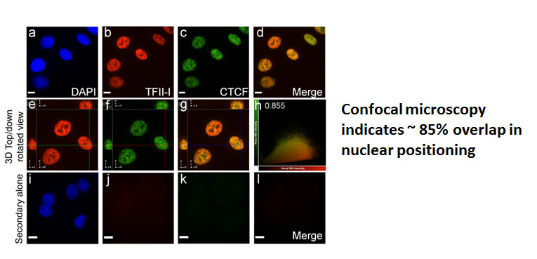 Confocal